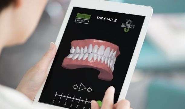 Dentiste examinant une simulation 3D d'une dentition avant-après le traitement DR SMILE