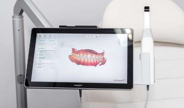 Photo d'un scanner 3D et sa simulation 3D d'une mâchoire après un examen DR SMILE